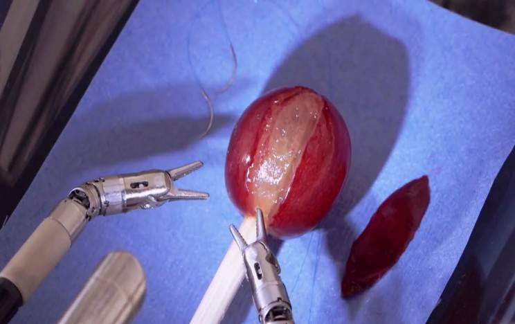 �@15���t(y��)���C���������ܕ�׌�t(y��)��ʧ�I(y��)